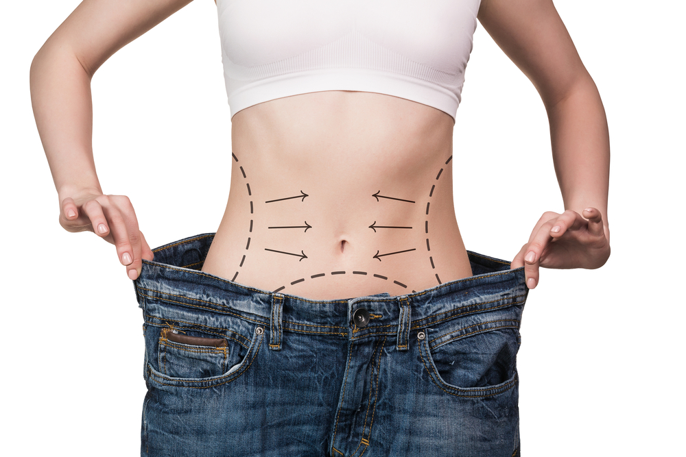 Απώλεια βάρους: Πώς αντιμετωπίζεται η υπερβολική χαλάρωση στο δέρμα